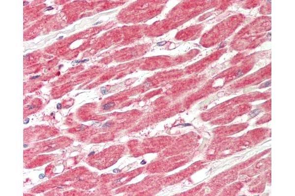 MTMR12 antibody  (C-Term)