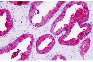 Human Prostate: Formalin-Fixed, Paraffin-Embedded (FFPE) (Prostate Specific Antigen antibody)