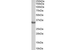 ABIN184697 staining (0. (STUB1 antibody  (C-Term))