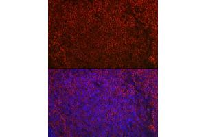 Immunofluorescence analysis of rat spleen using CD79a Rabbit pAb (ABIN1679100, ABIN3015116, ABIN3015118 and ABIN6213808) at dilution of 1:50 (40x lens).