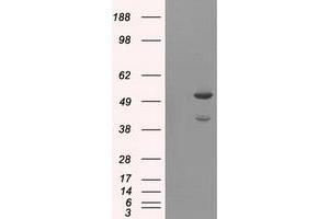 Western Blotting (WB) image for anti-V-Akt Murine Thymoma Viral Oncogene Homolog 2 (AKT2) antibody (ABIN1496566) (AKT2 antibody)