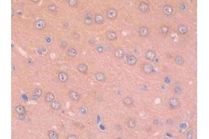 DAB staining on IHC-P;;Samples: Rat Cerebrum Tissue (Renin antibody  (AA 144-237))