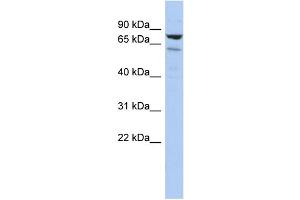 WB Suggested Anti-C1orf103 Antibody Titration: 0. (C1orf103 antibody  (Middle Region))