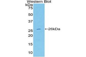 Western blot analysis of the recombinant protein. (DNASE1L2 antibody  (AA 32-229))