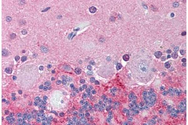 KCNJ6 antibody  (N-Term)