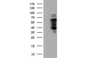 HEK293T cells were transfected with the pCMV6-ENTRY control (Left lane) or pCMV6-ENTRY NUMB (Right lane) cDNA for 48 hrs and lysed. (NUMB antibody)