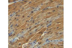 Used in DAB staining on fromalin fixed paraffin- embedded heart tissue (ANKRD1 antibody  (AA 6-291))