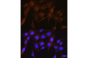 Immunofluorescence analysis of NIH-3T3 cells using PSMD4 Rabbit mAb (ABIN1681255, ABIN3017957, ABIN3017958 and ABIN7101547) at dilution of 1:100 (40x lens).