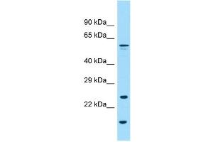 WB Suggested Anti-GPC6 Antibody Titration: 1. (Glypican 6 antibody  (N-Term))