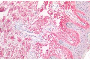 Detection of NTXI in Human Skin Tissue using Polyclonal Antibody to Cross Linked N-Telopeptide Of Type I Collagen (NTXI) (NTX-I antibody)