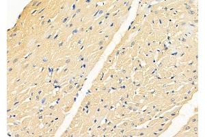 ABIN6262847 and ABIN6278586 at 1/100 staining Rat heart tissue by IHC-P. (KLHL3 antibody  (N-Term))