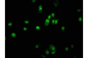 Immunofluorescence staining of MCF-7 cells with ABIN7162500 at 1:133, counter-stained with DAPI. (PAX5 antibody  (AA 362-391))