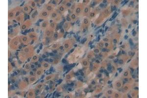 DAB staining on IHC-P; Samples: Rat Intestine Tissue (PROS1 antibody  (AA 416-646))