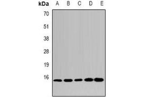 Western blot analysis of LSm4 expression in HepG2 (A), MCF7 (B), mouse kidney (C), mouse heart (D), rat liver (E) whole cell lysates. (LSM4 antibody)