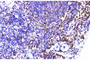 Immunohistochemistry of paraffin-embedded Mouse spleen using IL6R Polyclonal Antibody at dilution of 1:200 (IL-6 Receptor antibody)