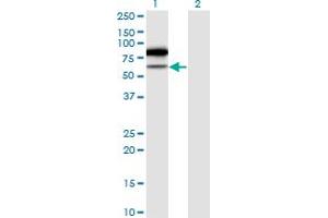 Western Blot analysis of TRMT2A expression in transfected 293T cell line by TRMT2A monoclonal antibody (M02), clone 4C10-1A11.