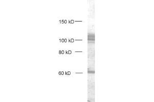 dilution: 1 : 1000, sample: crude synaptosomal fraction of rat brain (P2) (DLG3 antibody  (AA 14-26))