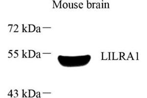 Western blot analysis of LILRA1 (ABIN7074490),at dilution of 1: 1000 (LILRA1 antibody)