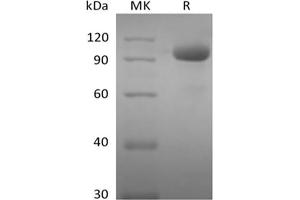 Western Blotting (WB) image for EPH Receptor A8 (EPHA8) protein (Fc Tag) (ABIN7319897) (EPH Receptor A8 Protein (EPHA8) (Fc Tag))