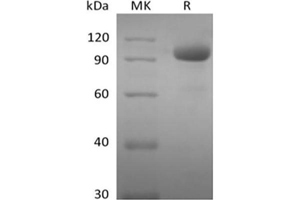 EPH Receptor A8 Protein (EPHA8) (Fc Tag)