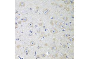 Immunohistochemistry of paraffin-embedded mouse brain using YES1 antibody (ABIN5974700) at dilution of 1/100 (40x lens). (YES1 antibody)