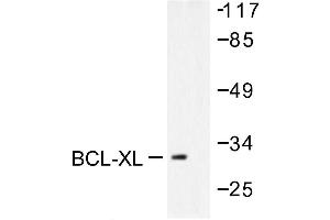 Image no. 1 for anti-BCL2-Like 1 (BCL2L1) antibody (ABIN265327) (BCL2L1 antibody)