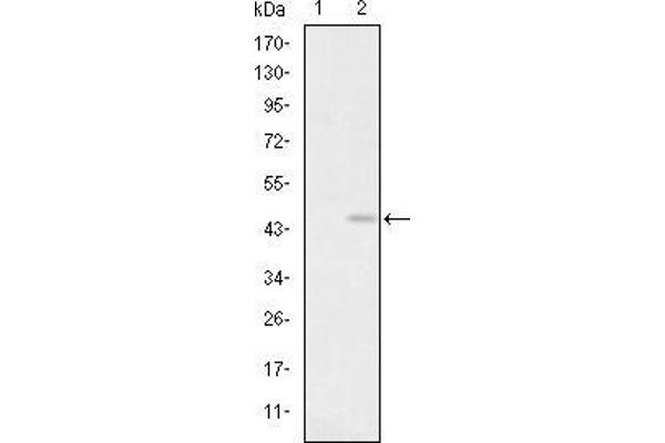 Glutamate Receptor 3 antibody