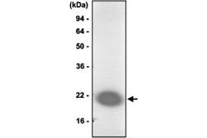 Western blot analysis of Jurkat cell lysate was resolved by SDS - PAGE , transferred to PVDF membrane and probed with PARK7 monoclonal antibody , clone 1B11 (1 : 1000)  . (PARK7/DJ1 antibody  (AA 1-189))