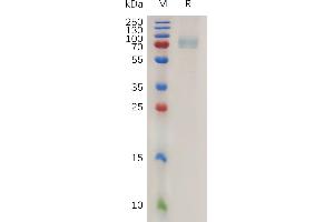 Human CD19 Protein, mFc Tag on SDS-PAGE under reducing condition. (CD19 Protein (AA 20-291) (mFc Tag))