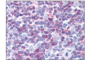 Human Tonsil: Formalin-Fixed, Paraffin-Embedded (FFPE) (IFITM1 antibody  (C-Term))
