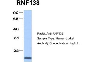 Human Jurkat; Host: Rabbit . (RNF138 antibody  (C-Term))