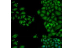 Immunofluorescence analysis of HeLa cells using NEFL Polyclonal Antibody (NEFL antibody)
