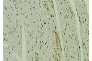 ABIN6279632 at 1/100 staining Mouse muscle tissue by IHC-P.