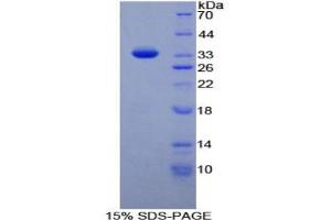 SDS-PAGE analysis of Rat Nucleoporin 88 kDa Protein.