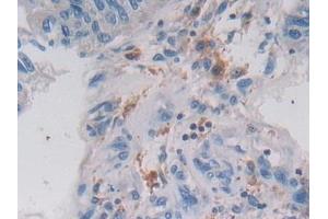 Immunohistochemistry (IHC) image for anti-Legumain (LGMN) (AA 18-433) antibody (ABIN7435007)