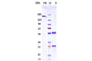 Anti-PDCD1 / PD-1 / CD279 Reference Antibody (serplulimab) on SDS-PAGE under reducing (R) condition. (Recombinant PDCD1 (Serplulimab Biosimilar) antibody)