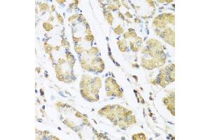 Immunohistochemistry of paraffin-embedded human stomach using MLN antibody (ABIN6128307, ABIN6143890, ABIN6143891 and ABIN6222013) at dilution of 1:100 (40x lens). (Motilin antibody  (AA 26-115))