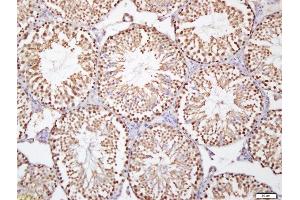 Immunohistochemistry (Paraffin-embedded Sections) (IHC (p)) image for anti-Antigen Identified By Monoclonal Antibody Ki-67 (MKI67) (AA 1201-1300) antibody (ABIN677858)