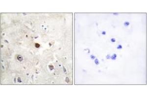 Immunohistochemistry analysis of paraffin-embedded human brain, using p57KIP2 Antibody. (CDKN1C antibody  (AA 11-60))
