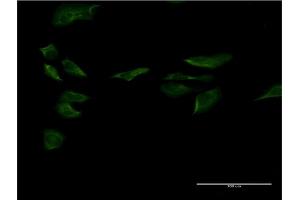 Immunofluorescence of monoclonal antibody to SP1 on HeLa cell. (SP1 antibody  (AA 522-618))