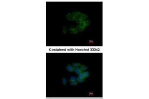 ICC/IF Image Immunofluorescence analysis of methanol-fixed HCT116, using MRCK alpha, antibody at 1:500 dilution. (CDC42BPA antibody)