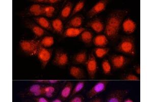 Immunofluorescence (IF) image for anti-Damage Specific DNA Binding Protein 1 (DDB1) antibody (ABIN7260707)