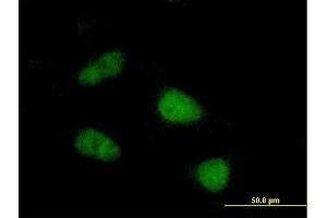 Immunofluorescence of purified MaxPab antibody to SIVA on HeLa cell. (SIVA1 antibody  (AA 1-110))