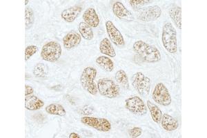 Immunohistochemistry (IHC) image for anti-Splicing Factor 3b, Subunit 1, 155kDa (SF3B1) (AA 200-250) antibody (ABIN7448791)