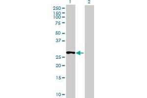 Western Blot analysis of C13orf39 expression in transfected 293T cell line ( H00196541-T01 ) by C13orf39 MaxPab polyclonal antibody. (METTL21C antibody  (AA 1-264))