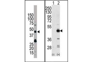 Image no. 1 for anti-Tribbles Homolog 3 (Drosophila) (TRIB3) (N-Term) antibody (ABIN360673) (TRIB3 antibody  (N-Term))