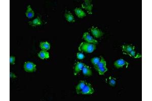 Immunofluorescent analysis of MCF-7 cells using ABIN7166144 at dilution of 1:100 and Alexa Fluor 488-congugated AffiniPure Goat Anti-Rabbit IgG(H+L) (SPIRE2 antibody  (AA 79-388))
