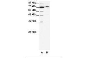 Image no. 1 for anti-Chromosome 14 Open Reading Frame 101 (C14orf101) (AA 249-298) antibody (ABIN6736042) (C14orf101 antibody  (AA 249-298))