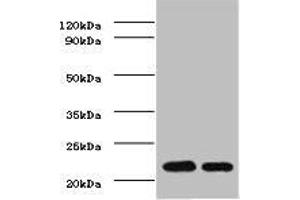 Western BlotPositive WB detected in: mouse heartAll lanes: TIMP1 antibody at 2ug/mlSecondaryGoat polyclonal to rabbit IgG at 1/50000 dilutionPredicted band size: 23 kDaObserved band size: 23 kDa. (TIMP1 antibody  (AA 24-207))