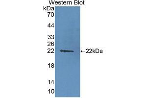 Figure. (DDB2 antibody  (AA 212-407))